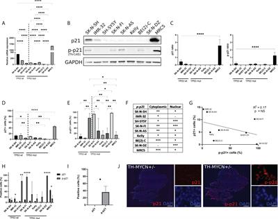 The cyclin dependent kinase inhibitor p21Cip1/Waf1 is a therapeutic target in high-risk neuroblastoma